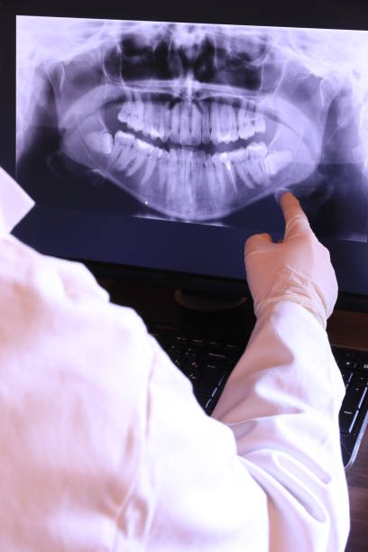 Best Emergency Tooth Extraction in Ebensburg, PA